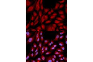 Immunofluorescence analysis of U2OS cell using BAG1 antibody. (BAG1 anticorps  (AA 1-230))