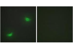Immunofluorescence analysis of HepG2 cells, using DUSP16 Antibody. (DUSP16 anticorps  (AA 571-620))