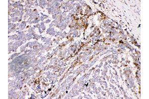 IHC analysis of Aquaporin 3 using anti- Aquaporin 3 antibody . (AQP3 anticorps  (C-Term))