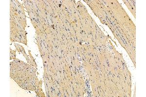 ABIN7096106 and ABIN7100168 at 1/100 staining rat muscle tissue by IHC-P.