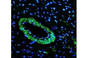IF analysis of TAGLN/Transgelin using anti-TAGLN/Transgelin antibody (ABIN7600099).