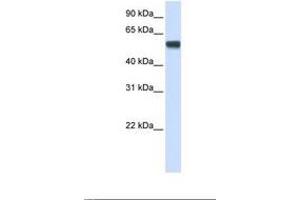 Image no. 1 for anti-Splicing Factor 3a, Subunit 3, 60kDa (SF3A3) (AA 341-390) antibody (ABIN6737944) (SF3A3 anticorps  (AA 341-390))