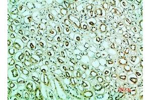 Immunohistochemical analysis of paraffin-embedded human-kidney, antibody was diluted at 1:200 (IRF3 anticorps  (AA 1268-1341))