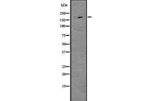 Western blot analysis of Nestin using MCF7 whole  lysates.