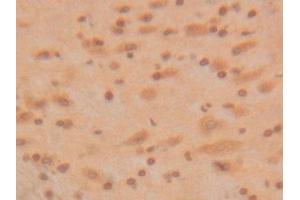 Detection of SOD1 in Rat Brain Tissue using Polyclonal Antibody to Superoxide Dismutase 1 (SOD1) (SOD1 anticorps  (AA 2-154))