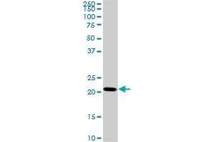 TRAPPC4 monoclonal antibody (M01), clone 2D10.