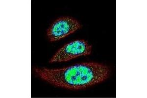 Confocal immunofluorescent analysis of TTRAP Antibody (C-term) Cat.