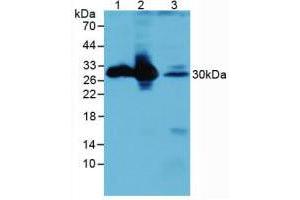 Figure. (CALB1 anticorps  (AA 3-261))
