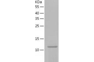 Western Blotting (WB) image for phosphohistidine Phosphatase 1 (PHPT1) (AA 1-125) protein (His-IF2DI Tag) (ABIN7124424)