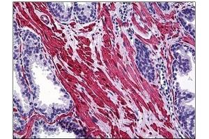 Immunohistochemistry (IHC) image for anti-SMAD Specific E3 Ubiquitin Protein Ligase 1 (SMURF1) antibody (ABIN781919)