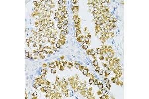 Immunohistochemistry of paraffin-embedded mouse testis using PIWIL1 antibody. (PIWIL1 anticorps)