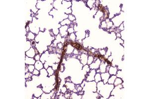 IHC analysis of C Reactive Protein using anti-C Reactive Protein antibody (ABIN5692861). (CRP anticorps  (AA 20-230))