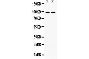 Western blot analysis of ABR expression in rat brain extract ( Lane 1) and mouse brain extract ( Lane 2). (ABR anticorps  (Middle Region))