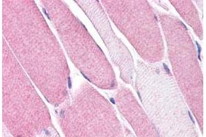Immunohistochemistry (Formalin/PFA-fixed paraffin-embedded sections) of human skeletal muscle tissue with BEST3 polyclonal antibody . (Bestrophin 3 anticorps  (Internal Region))