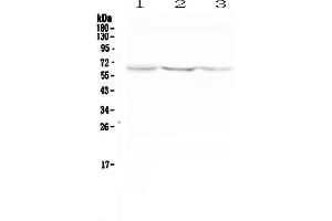 Western blot analysis of NOX2 using anti-NOX2 antibody . (CYBB anticorps  (AA 416-500))
