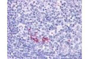 Image no. 1 for anti-Tumor Necrosis Factor (Ligand) Superfamily, Member 11 (TNFSF11) (AA 1-317) antibody (ABIN208246)