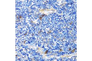 Immunohistochemistry of paraffin-embedded Human tonsil using PTCH1 antibody (ABIN1682368, ABIN1682367, ABIN3015342, ABIN3015343 and ABIN6213997) at dilution of 1:100 (40x lens). (Patched 1 anticorps  (AA 1214-1312))