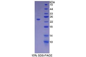 SDS-PAGE analysis of Mouse Dynamin 1 Protein. (Dynamin 1 Protein (DNM1))