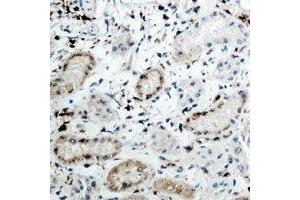 Immunohistochemical analysis of DCP1A staining in human kidney formalin fixed paraffin embedded tissue section. (DCP1A anticorps)