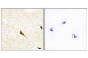 Immunohistochemistry (IHC) image for anti-MOK Protein Kinase (MOK) (Internal Region) antibody (ABIN1850096)