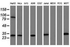 Image no. 4 for anti-Mitochondrial Translational Initiation Factor 3 (MTIF3) (AA 56-278) antibody (ABIN1491590) (MTIF3 anticorps  (AA 56-278))