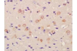 Formalin-fixed and paraffin embedded rat brain labeled with Rabbit Anti-FLRT2 Polyclonal Antibody, Unconjugated  at 1:200 followed by conjugation to the secondary antibody and DAB staining