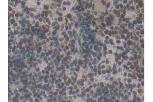 Detection of IRF2 in Mouse Spleen Tissue using Polyclonal Antibody to Interferon Regulatory Factor 2 (IRF2)