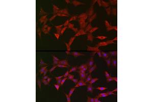 Immunofluorescence analysis of PC-12 cells using  Rabbit pAb (ABIN6129209, ABIN6137382, ABIN6137383 and ABIN6219595) at dilution of 1:150 (40x lens).