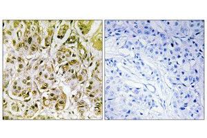 Immunohistochemistry (IHC) image for anti-SMAD, Mothers Against DPP Homolog 1 (SMAD1) (pSer187) antibody (ABIN1847368) (SMAD1 anticorps  (pSer187))