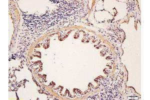 Formalin-fixed and paraffin embedded rat lung labeled with Rabbit Anti-Glycophorin C Polyclonal Antibody, Unconjugated (ABIN718991) at 1:200 followed by conjugation to the secondary antibody and DAB staining