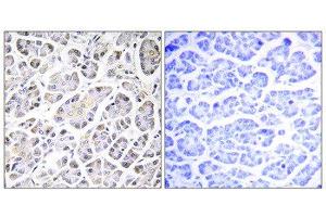 Immunohistochemistry (IHC) image for anti-ATP Synthase, H+ Transporting, Mitochondrial Fo Complex, Subunit C3 (Subunit 9) (ATP5G3) (N-Term) antibody (ABIN1850826) (ATP5G3 anticorps  (N-Term))