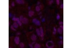 Immunofluorescence analysis of Human breast cancer tissue using Oct-1/2 Monoclonal Antibody at dilution of 1:200. (Oct-1/2 anticorps)