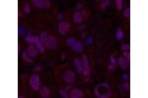 Immunofluorescence analysis of Human breast cancer tissue using Oct-1/2 Monoclonal Antibody at dilution of 1:200. (Oct-1/2 anticorps)