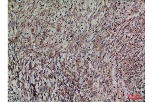 Immunohistochemistry (IHC) analysis of paraffin-embedded Human Brain, antibody was diluted at 1:100.