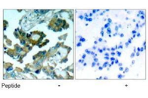 Image no. 1 for anti-PTK2 Protein tyrosine Kinase 2 (PTK2) (Tyr861) antibody (ABIN197234)