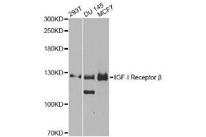 Western blot analysis of extracts of various cell lines, using IGF1R antibody (ABIN5970073) at 1/1000 dilution. (IGF1R anticorps  (N-Term))