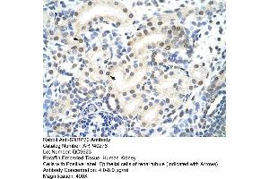 Rabbit Anti-SNRP70 Antibody  Paraffin Embedded Tissue: Human Kidney Cellular Data: Epithelial cells of renal tubule Antibody Concentration: 4. (SNRNP70 anticorps  (N-Term))