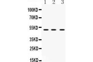 Western blot analysis of DR4 using anti-DR4 antibody .