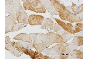 Immunoperoxidase of monoclonal antibody to CASQ2 on formalin-fixed paraffin-embedded human skeletal muscle.