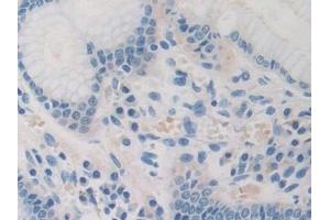 Detection of PDHX in Human Stomach Tissue using Polyclonal Antibody to Pyruvate Dehydrogenase Complex Component X (PDHX) (PDHX anticorps  (AA 220-468))