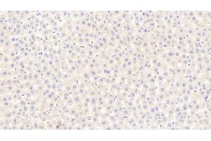 Detection of FGF21 in Rat Liver Tissue using Polyclonal Antibody to Fibroblast Growth Factor 21 (FGF21)