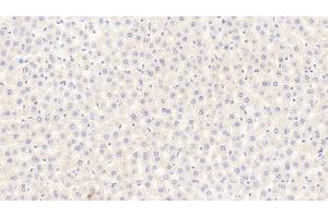 Detection of FGF21 in Rat Liver Tissue using Polyclonal Antibody to Fibroblast Growth Factor 21 (FGF21) (FGF21 anticorps  (AA 25-208))