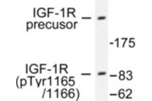 Image no. 1 for anti-Insulin-Like Growth Factor 1 Receptor (IGF1R) (pTyr1165), (pTyr1166) antibody (ABIN318046) (IGF1R anticorps  (pTyr1165, pTyr1166))