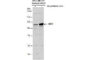 WB Image Untreated (–) and treated (+) MDA-MB-231 nuclear extracts (30 μg) were separated by 7.
