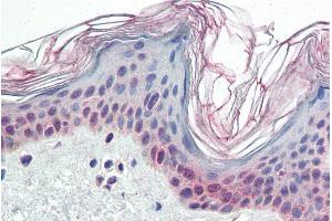ABIN185561 (5µg/ml) staining of paraffin embedded Human Skin. (PARP2 anticorps  (Internal Region))