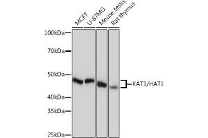 Western blot analysis of extracts of various cell lines, using K/H Rabbit mAb (ABIN7267702) at 1:1000 dilution. (HAT1 anticorps)