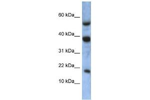 WB Suggested Anti-ATXN7L1 Antibody Titration: 0. (ATXN7L1 anticorps  (Middle Region))