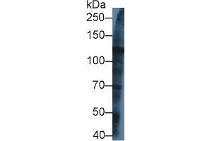 Western blot analysis of Human U2OS cell lysate, using Rat KIF5A Antibody (1 µg/ml) and HRP-conjugated Goat Anti-Rabbit antibody ( (KIF5A anticorps  (AA 823-1027))