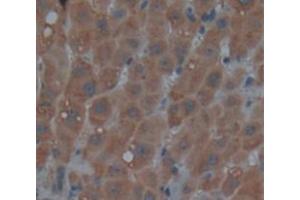 IHC-P analysis of Human Tissue, with DAB staining. (REV1 anticorps  (AA 834-976))