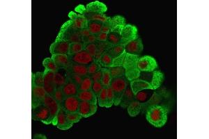 Immunofluorescence Analysis of PFA-fixed MCF-7 cells labeling HSP27 with HSP27 MAb (G3.